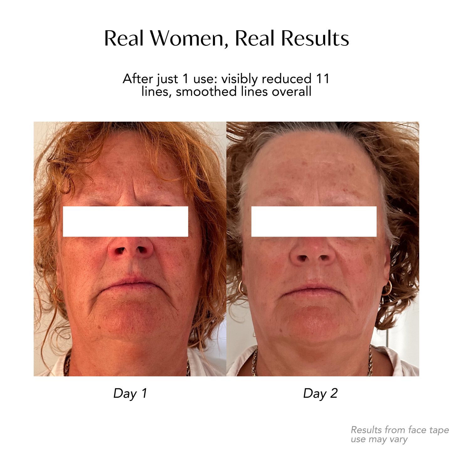 Face Tape Wrinkle Eraser - Smoothe Wrinkles While You Sleep