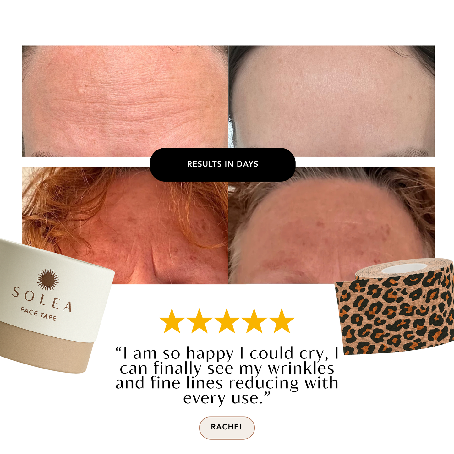 Face Tape Wrinkle Eraser - Smoothe Wrinkles While You Sleep